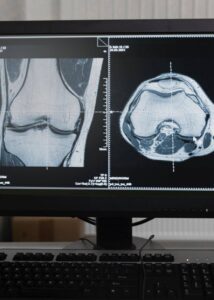 Определение костных тканей по результатам компьютерной томографии 